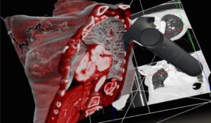 Le logiciel Diva facilite l’analyse d’images médicales grâce à la réalité virtuelle