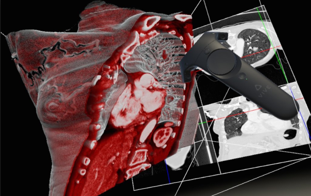 Le logiciel Diva facilite l’analyse d’images médicales grâce à la réalité virtuelle