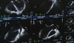 Le CHU de Bordeaux et Deski démocratisent l’échographie via l’IA