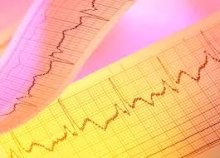 Bientôt un électrocardiogramme dopé à l’intelligence artificielle